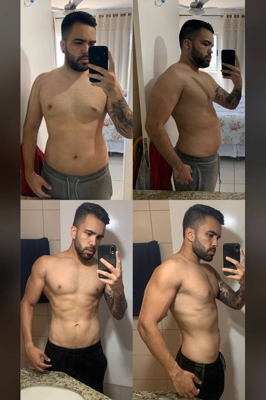 Antes e depois de paciente acompanhado no consultório