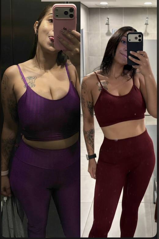 Antes e depois de paciente acompanhada no consultório