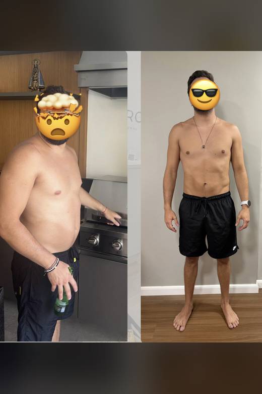 Antes e depois de paciente acompanhado no consultório